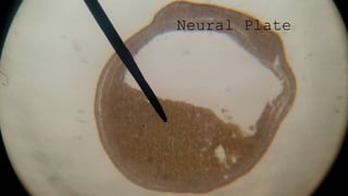 Neural Plate