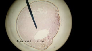 Neural Tube