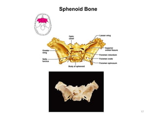 Sphenoid Bone
17
 