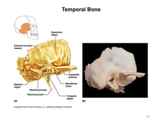 Temporal Bone
26
 