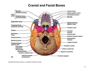 Cranial and Facial Bones
29
 