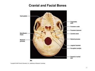Cranial and Facial Bones
31
 
