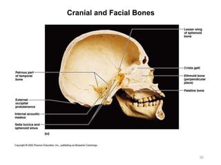 Cranial and Facial Bones
35
 