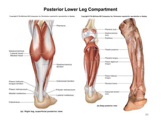 99
Posterior Lower Leg Compartment
 