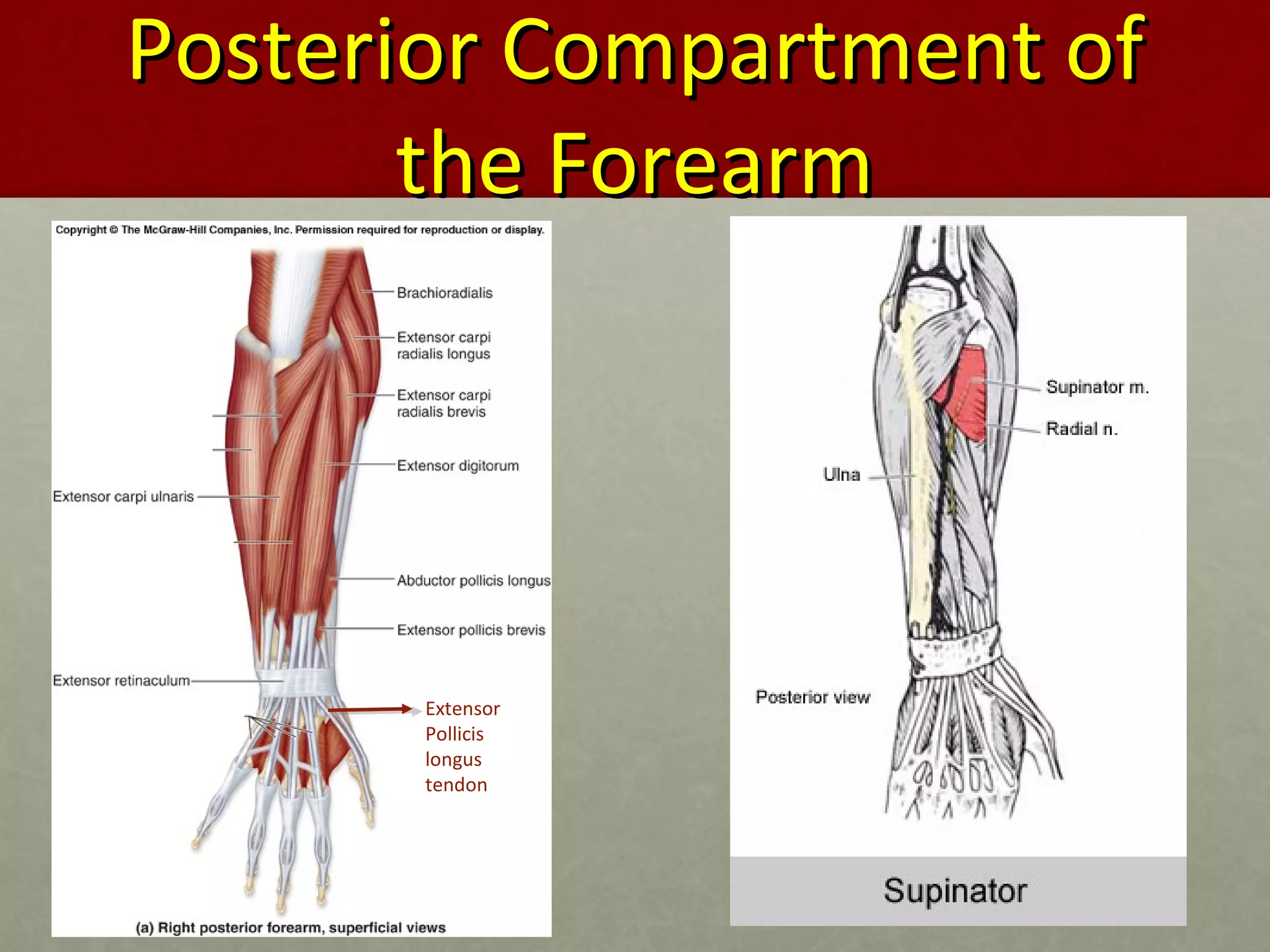 PPoosstteerriioorr CCoommppaarrttmmeenntt ooff 
tthhee FFoorreeaarrmm 
Extensor 
Pollicis 
longus 
tendon 
 