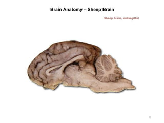 Brain Anatomy – Sheep Brain
12
 