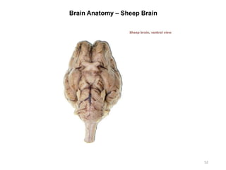 Brain Anatomy – Sheep Brain
52
 