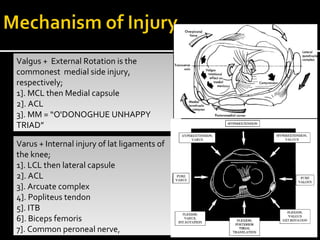 Valgus + External Rotation is the
commonest medial side injury,
respectively;
1]. MCL then Medial capsule
2]. ACL
3]. MM = “O'DONOGHUE UNHAPPY
TRIAD”
Valgus + External Rotation is the
commonest medial side injury,
respectively;
1]. MCL then Medial capsule
2]. ACL
3]. MM = “O'DONOGHUE UNHAPPY
TRIAD”
Varus + Internal injury of lat ligaments of
the knee;
1]. LCL then lateral capsule
2]. ACL
3]. Arcuate complex
4]. Popliteus tendon
5]. ITB
6]. Biceps femoris
7]. Common peroneal nerve,
Varus + Internal injury of lat ligaments of
the knee;
1]. LCL then lateral capsule
2]. ACL
3]. Arcuate complex
4]. Popliteus tendon
5]. ITB
6]. Biceps femoris
7]. Common peroneal nerve,
 