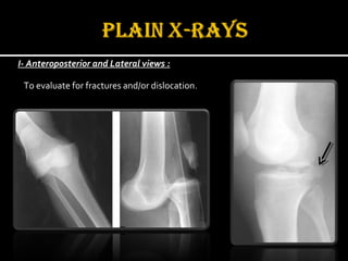 I- Anteroposterior and Lateral views :
To evaluate for fractures and/or dislocation.
 
