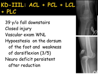 39 y/o fall downstairs
Closed injury
Vascular exam WNL
Hypoestesia on the dorsum
of the foot and weakness
of dorsiflexion (3/5)
Neuro deficit persistent
after reduction
 