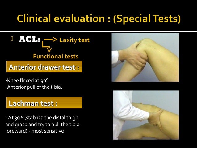 Knee Injuries