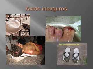 Actos inseguros