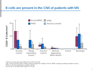 B cells are present in the CNS of patients with MS
3
*Normal controls typically exhibit few B cells in the CNS.
CNS, central nervous system; PPMS, primary progressive multiple sclerosis; RRMS, relapsing remitting multiple sclerosis;
SPMS, secondary progressive multiple sclerosis.
Frischer JM, et al. Brain 2009;132(pt 5):1175–89.
Activity
Lesions
Slowly
Expanding
Lesions
Normal-
Appearing
White Matter
Inactive
Lesions
Cortex Meninges
CD20+BCells/mm2
20
10
0
Acute/RRMS
PPMS
SPMS
Normal controls*
 