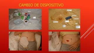 CAMBIO DE DISPOSITIVO
 