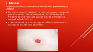 e) Estenosis
Por procesos infecciosos acompañados de inflamación que oblitera la luz
intestinal.
 Consiste en un estrechamiento de la luz del estoma. La estenosis
puede ser relativa si el dedo explorador no pasa libremente a
través del estoma y absoluta cuando el dedo explorador no
pasa a través del estoma.
 Cuidados: Hacer dilataciones digitales periódicas e intentar su
aprendizaje por parte del ostomizado.
 