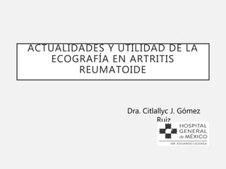 ACTUALIDADES Y UTILIDAD DE LA
ECOGRAFÍA EN ARTRITIS
REUMATOIDE
Dra. Citlallyc J. Gómez
Ruiz
 