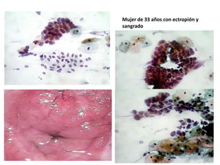 citología cervicovaginal