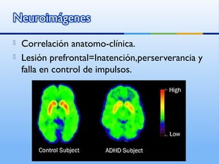  Correlación anatomo-clínica.
 Lesión prefrontal=Inatención,perserverancia y
falla en control de impulsos.
 