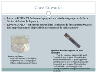 Chez Edwards
 La valve SAPIEN XT évolue en s’appuyant sur la technologie éprouvée de la
Sapien et devient la Sapien 3
 La valve SAPIEN 3 est conçue pour réduire les risques de fuites paravalvulaires
tout en présentant un dispositif de mise en place de petit diamètre
Jupe extérieure
 Jupe extérieure en Polyéthylène
téréphtalate (PET) conçue pour
réduire les fuites paravalvulaires
Système de mise en place de petit
diamètre
(Pour les valves de 23 mm et 26 mm)
 Compatible avec la gaine d’introduction
expansible eSheath 14 F* pour l’approche
transfémorale avec le système Commander
 Compatible avec la gaine d’introduction
Certitude 18F** pour les approches
transapicale et transaortique avec le système
Certitude.
 