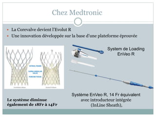 Chez Medtronic
 La Corevalve devient l’Evolut R
 Une innovation développée sur la base d’une plateforme éprouvée
Système EnVeo R, 14 Fr équivalent
avec introducteur intégrée
(InLine Sheath),
System de Loading
EnVeo R
Le système diminue
également de 18Fr à 14Fr
 