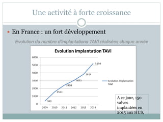 Une activité à forte croissance
 En France : un fort développement
Evolution du nombre d’implantations TAVI réalisées chaque année
A ce jour, 150
valves
implantées en
2015 aux HUS,
 