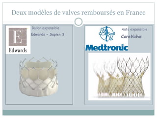Deux modèles de valves remboursés en France
– Ballon expansible
– Edwards – Sapien 3
Auto expansible
CoreValve
 