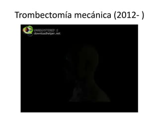 Trombectomía mecánica (2012- )
 