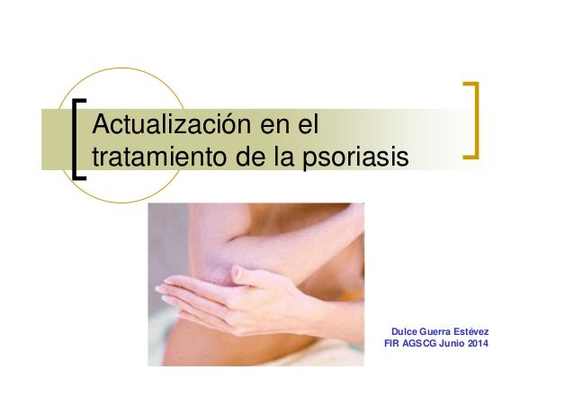 Que tal la psoriasis como él se ve