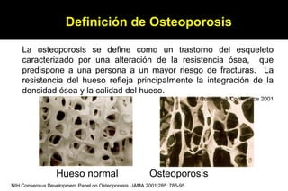Definición de Osteoporosis

    La osteoporosis se define como un trastorno del esqueleto
    caracterizado por una altera...