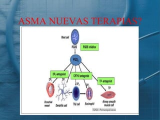 ASMA NUEVAS TERAPIAS?
 