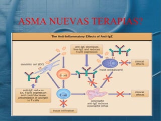 ASMA NUEVAS TERAPIAS?
 