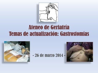 Ateneo de Geriatría
Temas de actualización: Gastrostomías
- 26 de marzo 2014 -
 