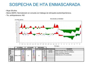 SOSPECHA DE HTA ENMASCARADA
- Mujer 58 años.
- Motivo MAPA: Normotensión en consulta con hallazgo de retinopatía esclerohipertensiva.
- Tto. antihipertensivo: NO




                  24 HORAS     ACTIVIDAD       DESCANSO
    VARIABLE LECTURAS MEDIA LECTURAS        LECTURAS MEDIA PROFUNDIDAD                         PACIENTE
    PAS                   130          136            104     23,52%   Valores promedio 24h: HTA limítrofe
    PAD                    82           86             63     26,74%   Patrón circadiano: DIPPER EXTREMO
    FCM                    81           83             73              Cargas tensionales elevadas.
    PP                     48           50             41              Variabilidad de la TAs aumentada
             64(64) 100%       51               13
       PAS               34%            41%             8%
    CT
       PAD               47%            51%            31%
       PAS               19,10
    VT
       PAD               13,40
 