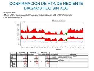 CONFIRMACIÓN DE HTA DE RECIENTE
             DIAGNÓSTICO SIN AOD
- Varón 45 años.
- Motivo MAPA: Confirmación de HTA de reciente diagnóstico sin AOD y RCV añadido bajo.
- Tto. antihipertensivo: NO




                       24 HORAS     ACTIVIDAD       DESCANSO
         VARIABLE LECTURAS MEDIA LECTURAS        LECTURAS MEDIA PROFUNDIDAD                        PACIENTE
         PAS                   147          152            132     13,15%   Valores promedio 24h: HTA Grado 1
         PAD                    92           95             83     12,63%   Patrón circadiano: DIPPER
         FCM                    62           64             56              Cargas tensionales elevadas.
         PP                     55           57             49              PP elevada.
                  65(65) 100%       49               16
            PAS               92%            94%            88%
         CT
            PAD               89%            90%            88%
            PAS               15,30
         VT
            PAD               10,40
 