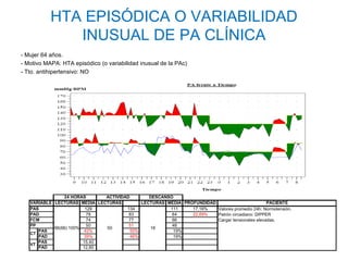 HTA EPISÓDICA O VARIABILIDAD
              INUSUAL DE PA CLÍNICA
- Mujer 64 años.
- Motivo MAPA: HTA episódico (o variabilidad inusual de la PAc)
- Tto. antihipertensivo: NO




                 24 HORAS     ACTIVIDAD        DESCANSO
   VARIABLE LECTURAS MEDIA LECTURAS         LECTURAS MEDIA PROFUNDIDAD                         PACIENTE
   PAS                   129          134             111     17,16%   Valores promedio 24h: Normotensión.
   PAD                   78            83              64     22,89%   Patrón circadiano: DIPPER
   FCM                   74            77              66              Cargar tensionales elevadas.
   PP                    50            51              48
            66(66) 100%       50               16
      PAS               42%             50%            19%
   CT
      PAD               39%             46%            19%
      PAS               15,40
   VT
      PAD               12,80
 