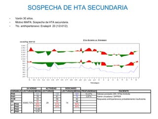 SOSPECHA DE HTA SECUNDARIA
-      Varón 30 años.
-      Motivo MAPA: Sospecha de HTA secundaria.
-      Tto. antihipertensivo: Enalapril 20 (1/2-01/2)




                 24 HORAS      ACTIVIDAD         DESCANSO
    VARIABLE LECTURAS MEDIA LECTURAS          LECTURAS MEDIA PROFUNDIDAD                         PACIENTE
    PAS                  131           135              121     10,37%   Valores promedio 24h: HTAs limítrofe
    PAD                   78            81               73      3,87%   Patrón circadiano: DIPPER
    FCM                   53            59               40              Respuesta antihipertensiva probablemente insuficiente.
    PP                    52            54               48
             43(60) 72%        29                14
       PAS              44%            41%              50%
    CT
       PAD              37%            24%              64%
       PAS              10,80
    VT
       PAD               9,20
 