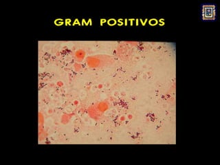 GRAM POSITIVOS
 