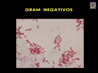 GRAM NEGATIVOS
 