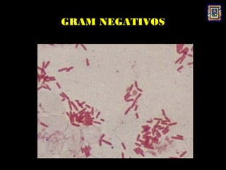 GRAM NEGATIVOS
 