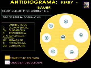 ANTIBIOGRAMA:                          KIRBY -
                           BAUER
MEDIO: MULLER HINTON BROTH ó T. S. B.

TIPO DE SIEMBRA: DISEMINACIÓN.
                                                   C
      ANTIBIOTICOS                      T
C:   CLORANFENICOL.
CM: CLINDAMICINA
E:   ERITROMICINA.
                                                              CM
STX: SULFAMETROXASOL +
TRIMETOPRIMA                      E           AM
AM: AMOXICILINA
T:  TETRACICLINA.
GM: GENTAMICINA.

                                        STX             GM



    CRECIMIENTO DE COLONIAS.
                                                       m m.
   NO CRECIMIENTO DE COLONIAS.
 