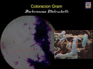 Coloracion Gram
Bacterionema Matruchotti
 