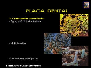 PLACA DENTAL
  3. Colonización secundaria:
  - Agregación interbacteriana




  - Multiplicación




  - Condiciones acidógenas:

Veillonela y Lactobacillus
 