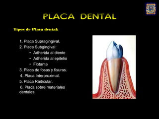 PLACA DENTAL
Tipos de Placa dental:


  1. Placa Supragingival.
  2. Placa Subgingival:
        • Adherida al diente
        • Adherida al epitelio
        • Flotante
  3. Placa de fosas y fisuras.
  4. Placa Interproximal.
  5. Placa Radicular.
  6. Placa sobre materiales
  dentales.
 