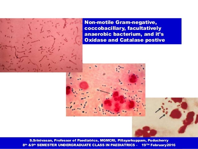 Acute bacterial (Pyogenic) meningitis - Dr. S. Srinivasan ...