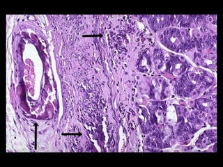 Acumulaciones intracelulares