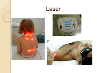 Laser
 