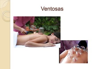 Ventosas
 