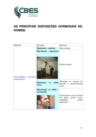 17
AS PRINCIPAIS DISFUNÇÕES HORMONAIS NO
HOMEM.
Glândula Disfunção Sintomas
Adeno-hipófise (hormônio
somatotrófico)
Hipofunção – nanismo Baixa estatura
Hiperfunção – gigantismo
Grande estatura
Hipofunção no adulto
(rara)
Alterações no controle da
glicemia e descalcificação
óssea.
Hiperfunção no adulto -
acromegalia
Espessamento ósseo anormal
nos dedos, queixo, nariz,
mandíbula, arcada
superciliar
 