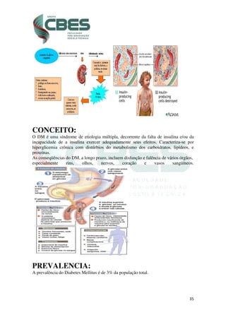35
CONCEITO:
O DM é uma síndrome de etiologia múltipla, decorrente da falta de insulina e/ou da
incapacidade de a insulina exercer adequadamente seus efeitos. Caracteriza-se por
hiperglicemia crônica com distúrbios do metabolismo dos carboidratos, lipídeos, e
proteínas.
As conseqüências do DM, a longo prazo, incluem disfunção e falência de vários órgãos,
especialmente rins, olhos, nervos, coração e vasos sangüíneos.
PREVALENCIA:
A prevalência do Diabetes Mellitus é de 3% da população total.
 