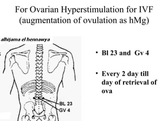 For Ovarian Hyperstimulation for IVF
(augmentation of ovulation as hMg)
• Bl 23 and Gv 4
• Every 2 day till
day of retrieval of
ova
 